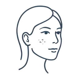 Image for indication Acne Sc